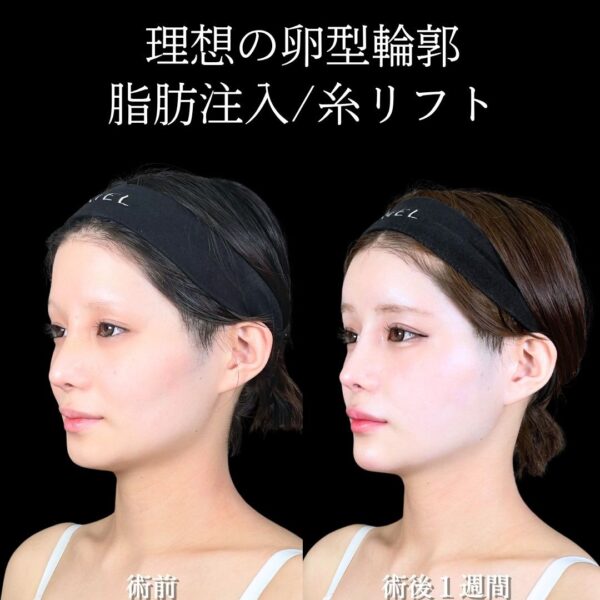No.16735の症例写真